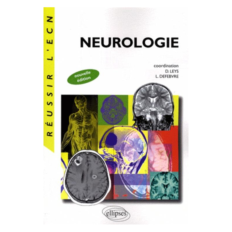 Neurologie. Nouvelle édition