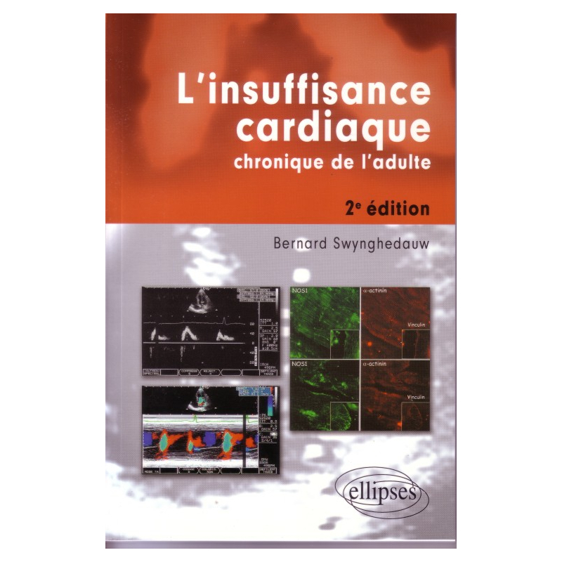 L'insuffisance cardiaque chronique de l'adulte - Nouvelle édition