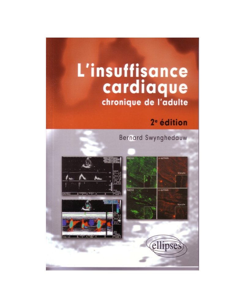 L'insuffisance cardiaque chronique de l'adulte - Nouvelle édition