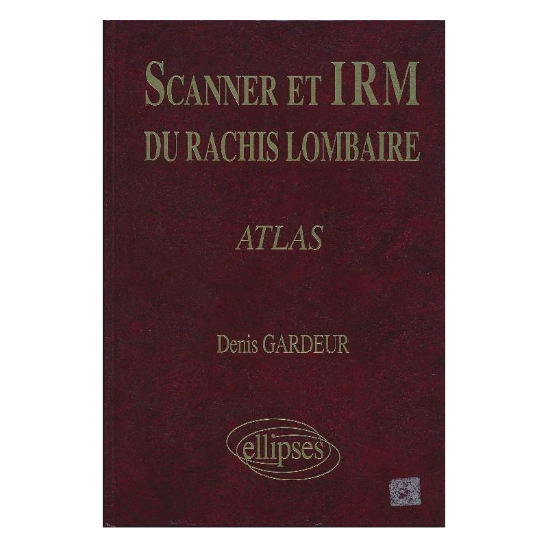 SCANNER IRM RACHIS LOMB.ATLAS